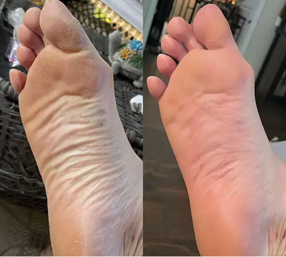 4Feet (1)